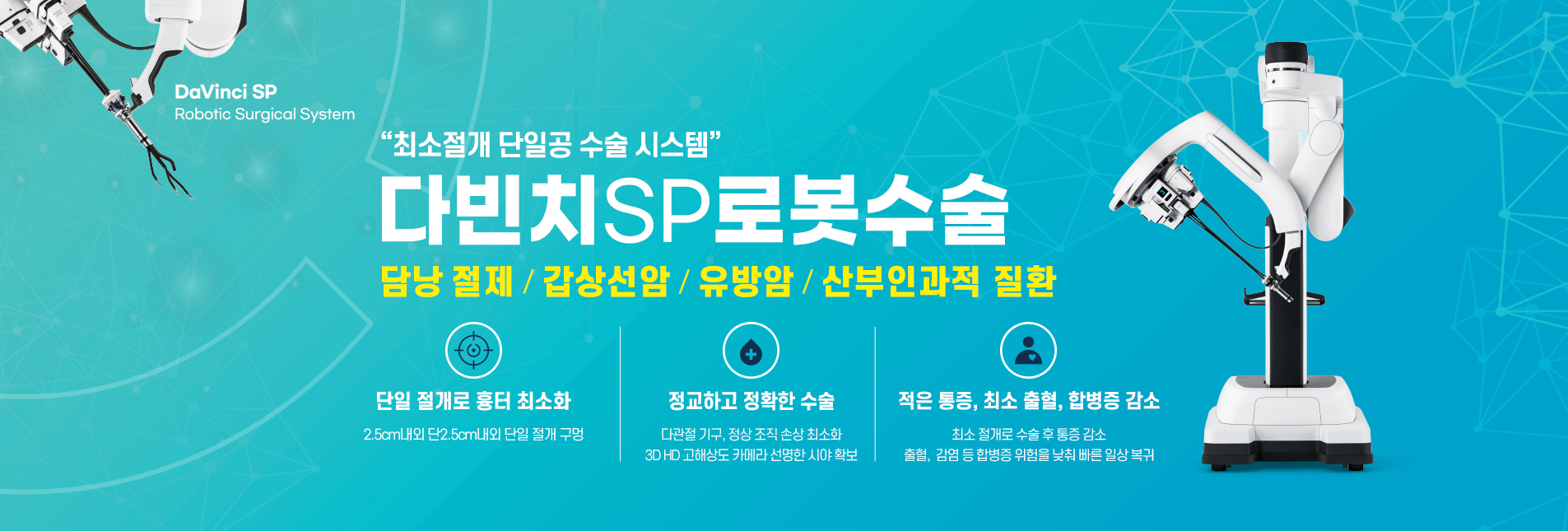 좋은강안병원 다빈치SP로봇수술